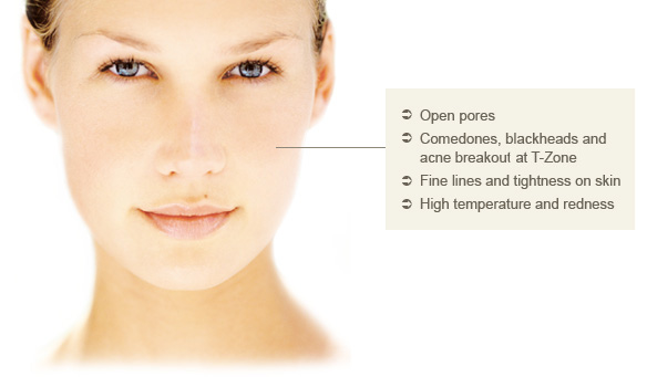 Combination Skin: Open pores, comedones, blackheads and acne breakout at T-Zone, Fine lines and tightness on skin, high temperature and redness